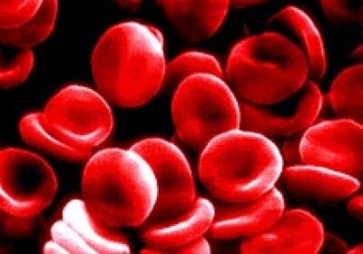 The experiment will study the selective destruction of young red blood cells