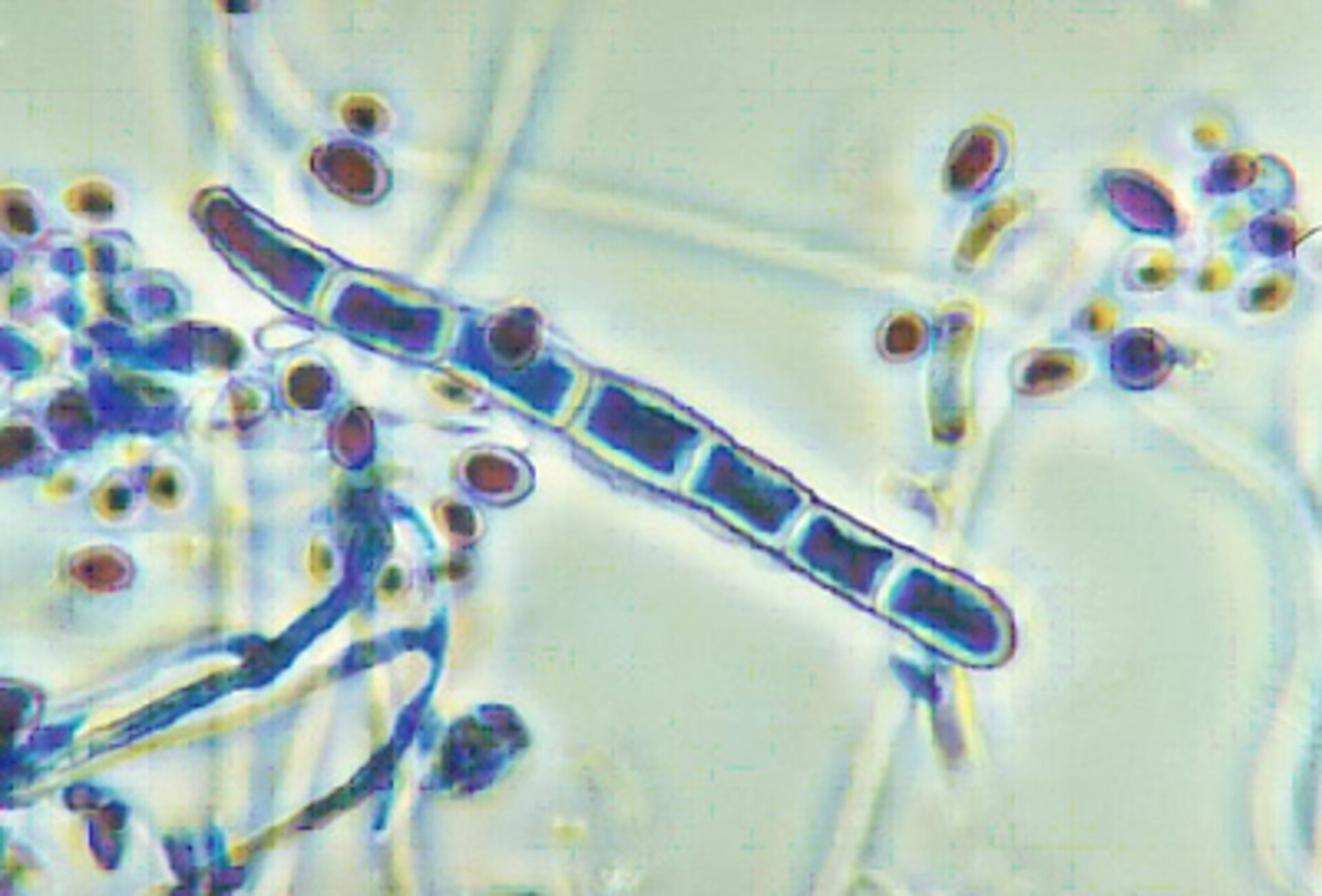 Fungus Trichophyton rubrum