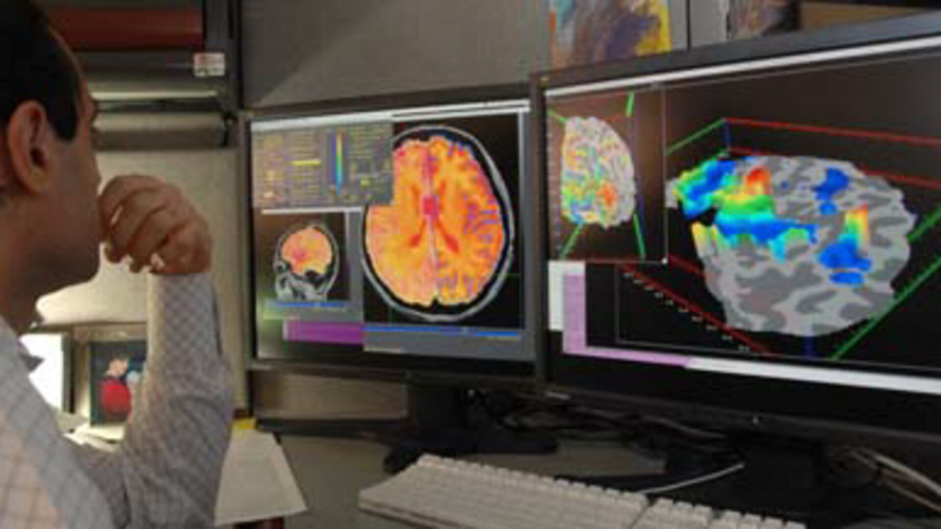 Checking brain scans