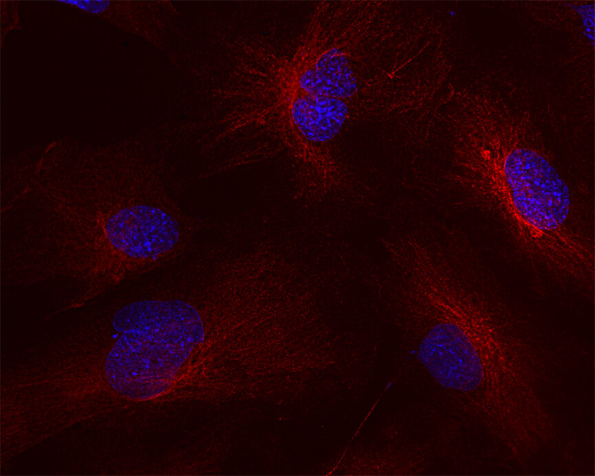 Human Microvascular Endothelial Cells (HMEC-1)