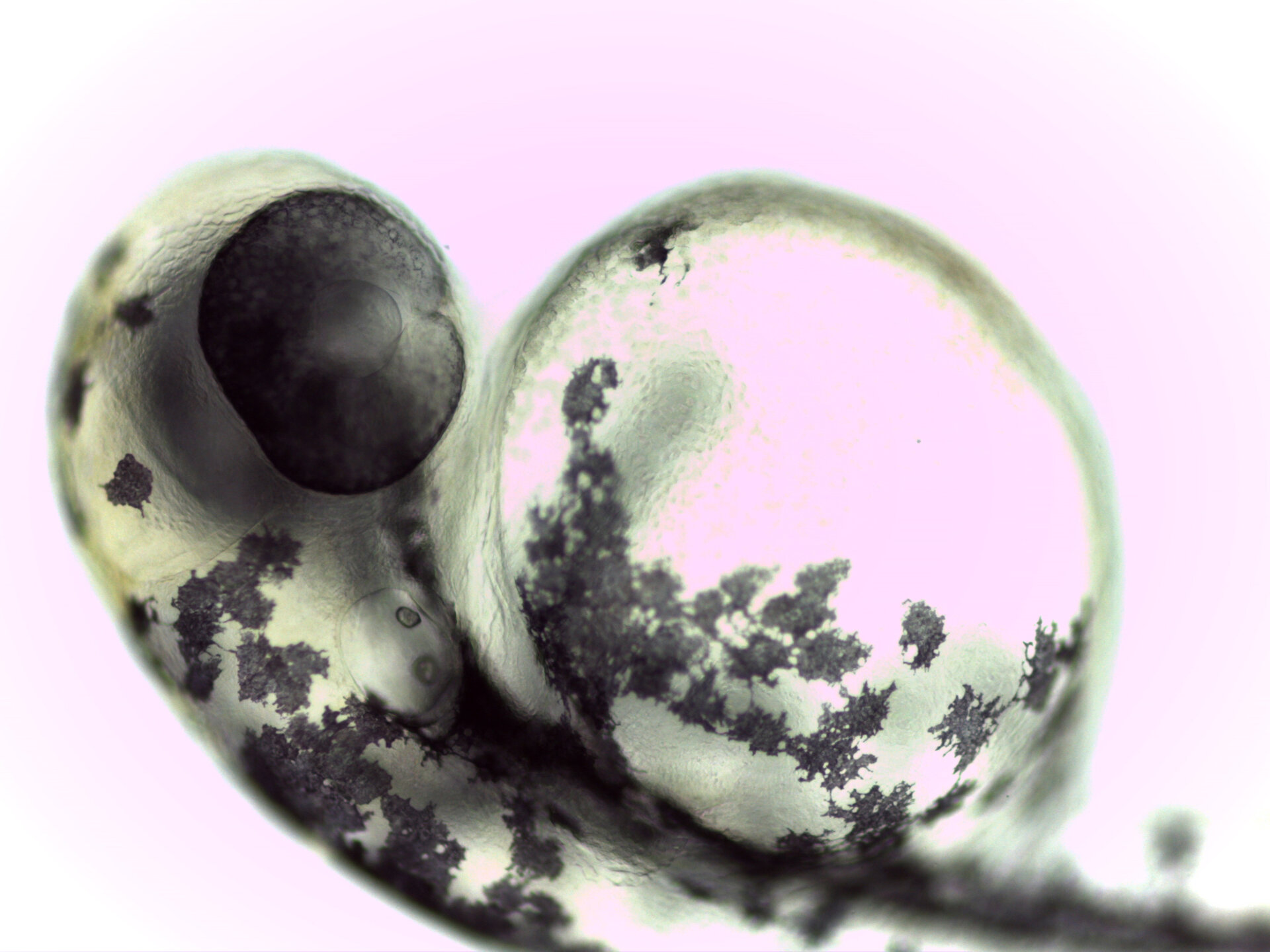 Zebrafish embryo