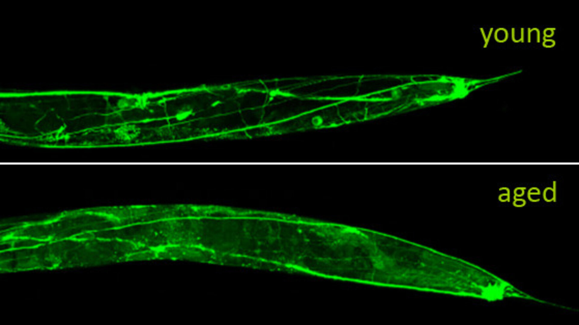 Neuronal deterioration of a worm as it ages