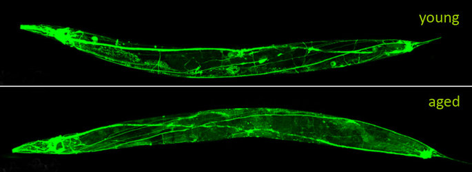 Neuronal deterioration of worm during ageing